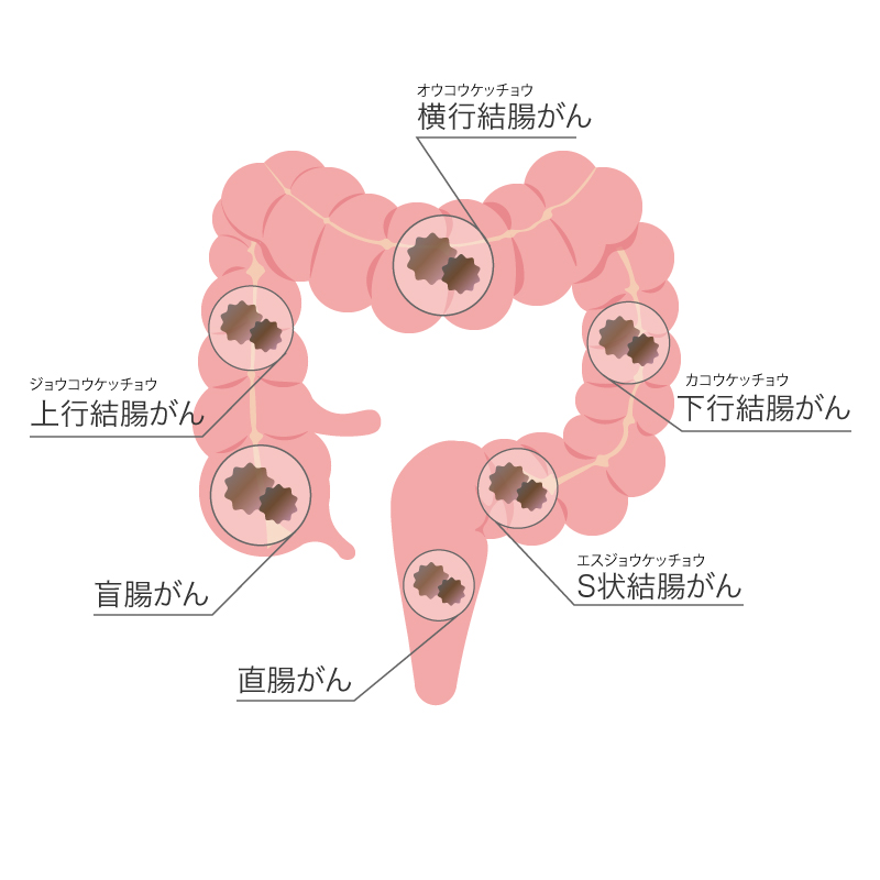 大腸検査で見る場所